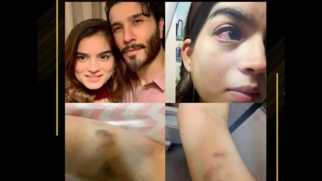 Pakistani star Feroze Khan’s ex-wife shares shocking pics of domestic violence
