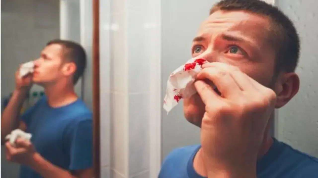 A man trying to stop his nose bleeding with tissues 