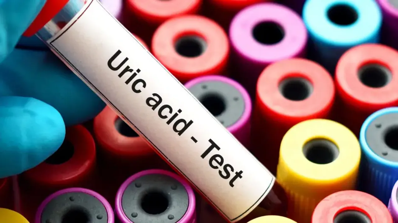 High uric acid levels