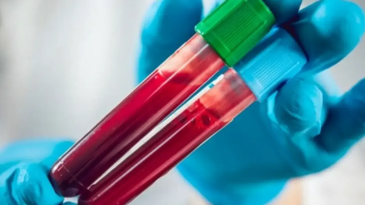 Now a simple blood test may help detect anxiety, its severity