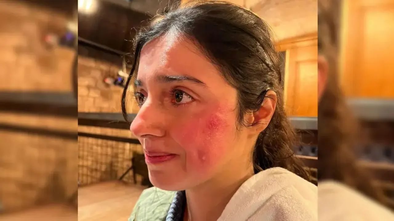 Divya Khosla Kumar gets injured while shooting for her upcoming project