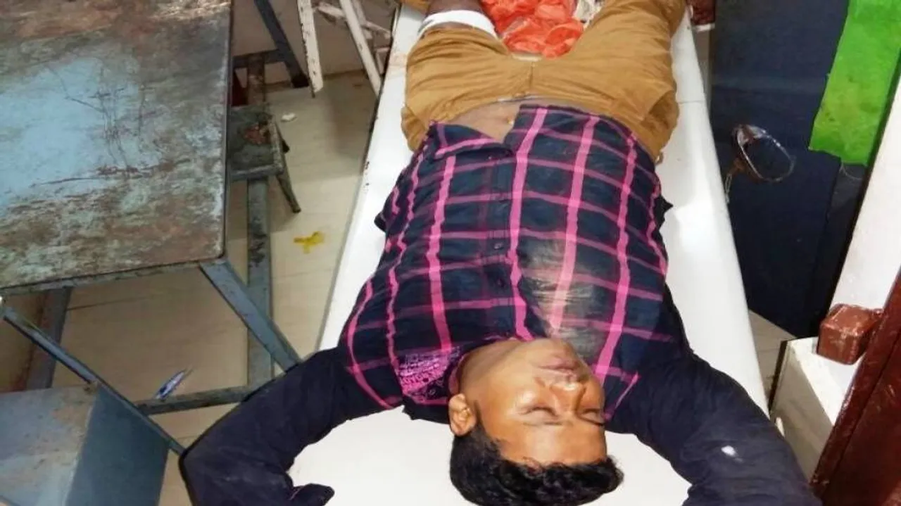 Criminal injured in encounter