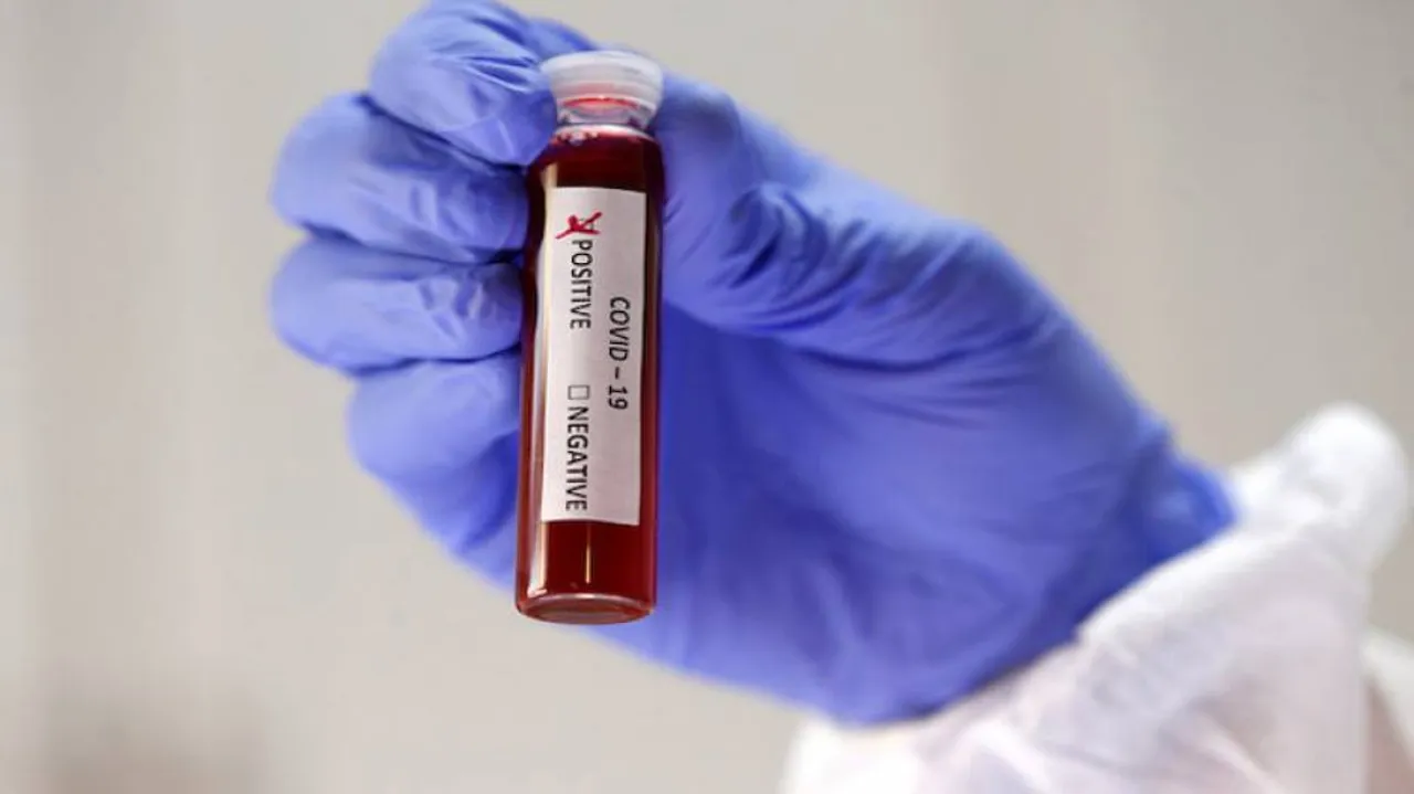 COVID-19 Cases In India Breach 85-Lakh Mark