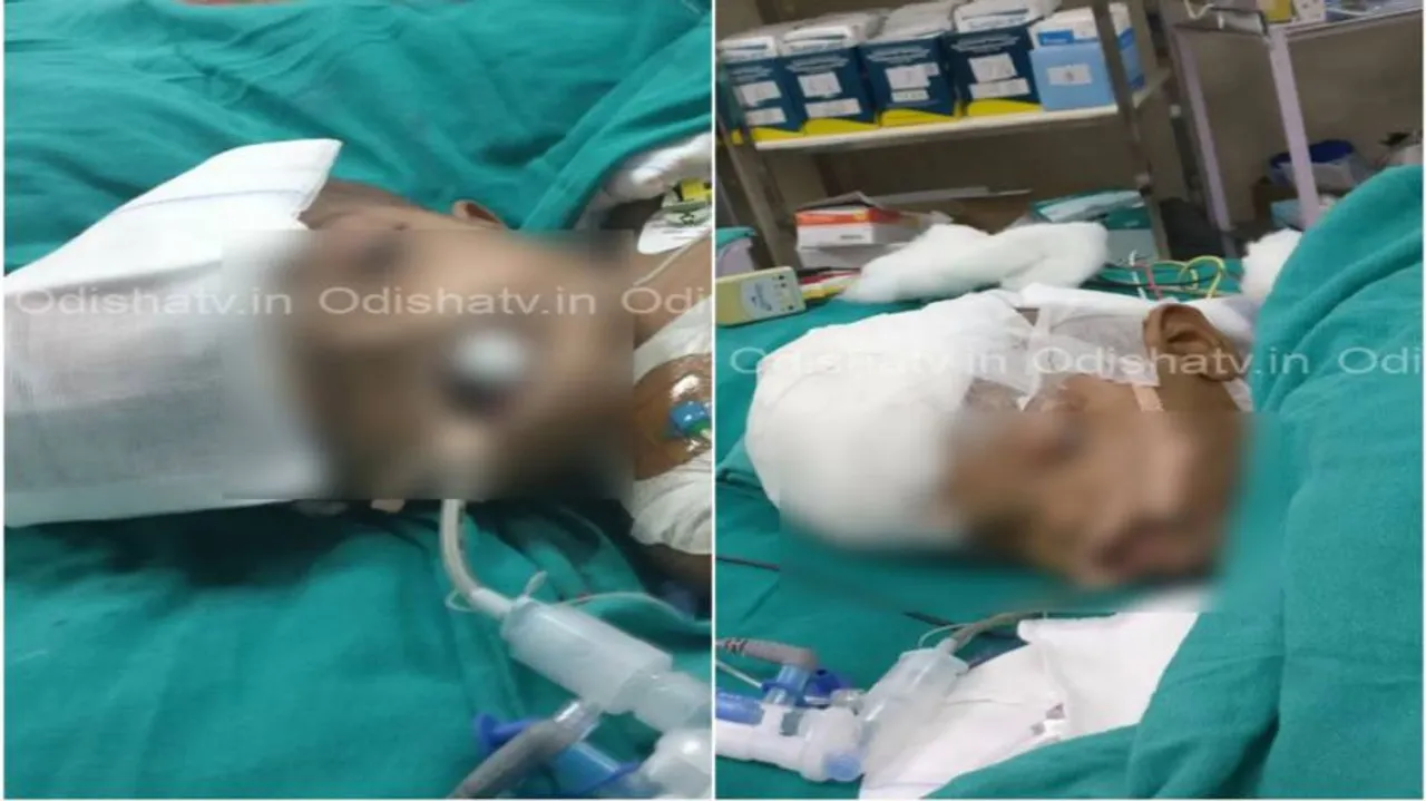 Condition of Jaga, Kalia now stable: Odisha Health Minister