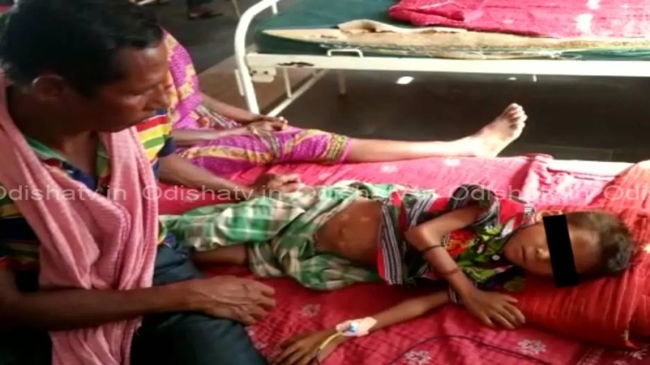 7-year-old branded with hot iron again in Keonjhar