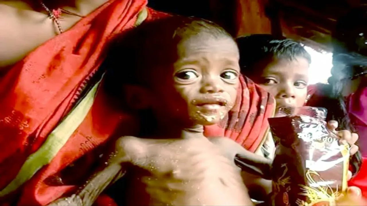 Mansi, face of Nagada malnutrition dies