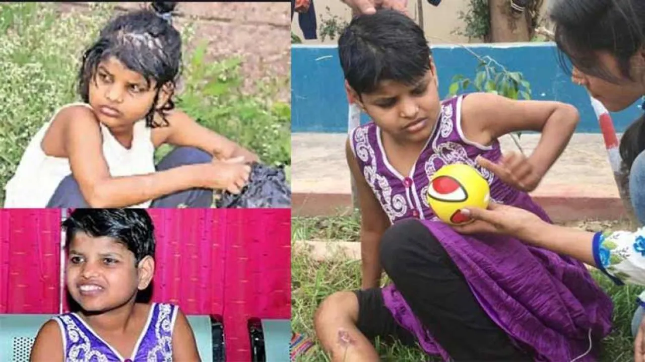 Mowgli Girl’s Tale: Journey From The Wilds To Social