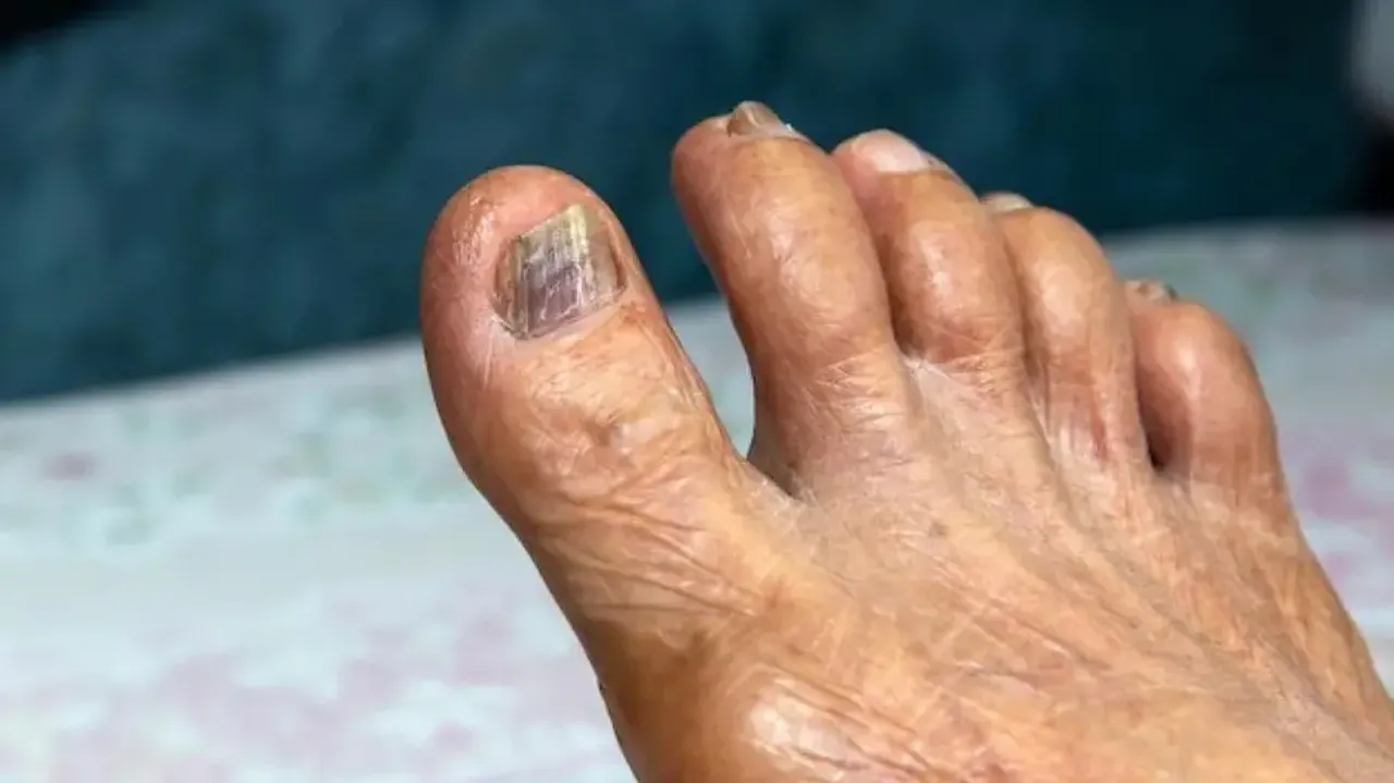 yellowing or brittle nails could prove dangerous