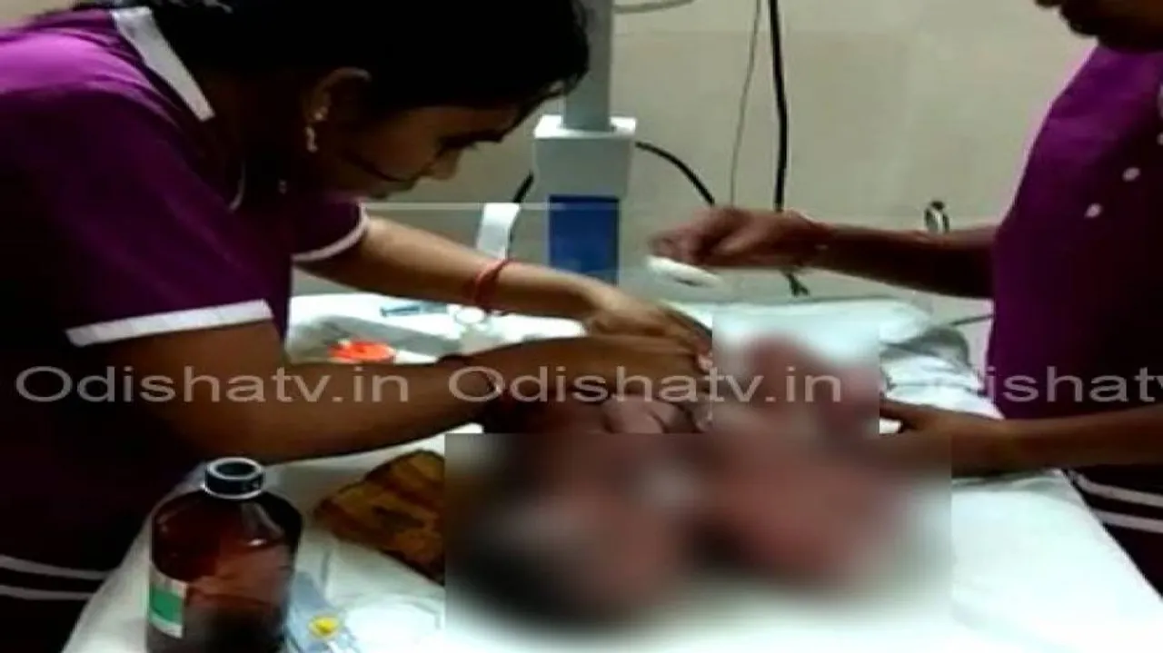 Nayagarh conjoined twins pass away