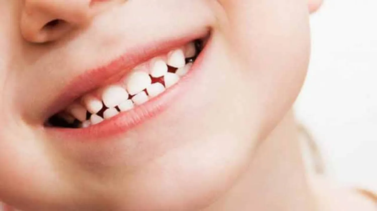 New Teeth Gel May Prevent Dental Cavities, Tooth Decay