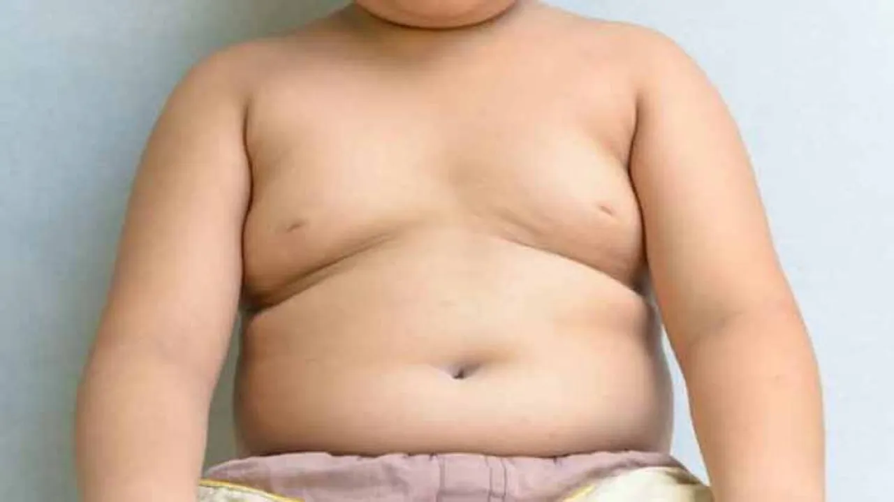 'Only Child' 7 Times More Likely To Be Obese