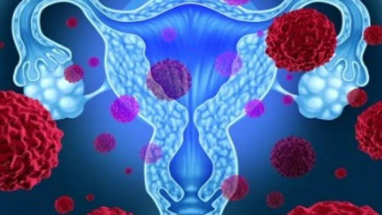 Stay Vigilant As Ovarian Cancer Has 'Silent' Symptoms