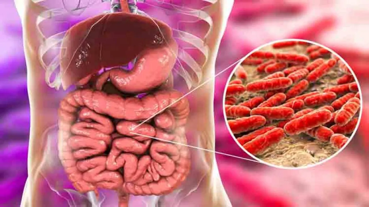 Israeli research shows probiotics treatment may harm intestines