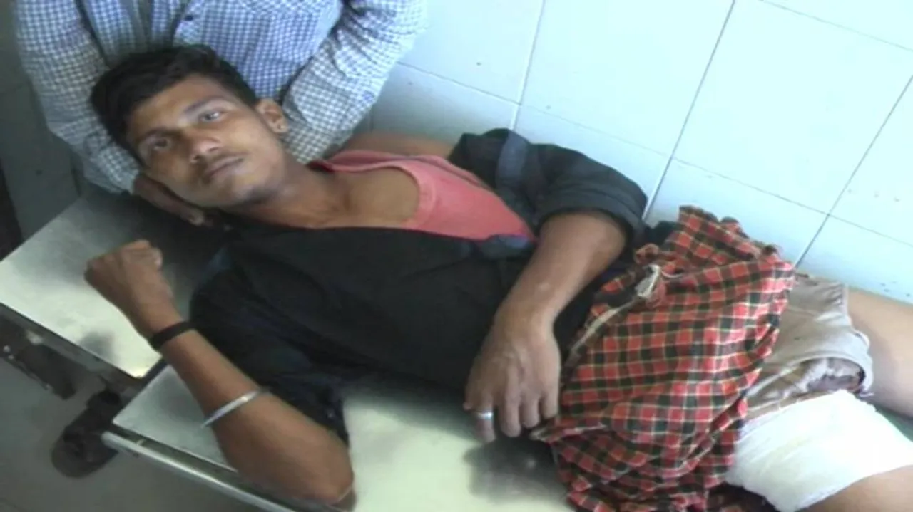 College student hurt in firing in Salepur; police begin probe