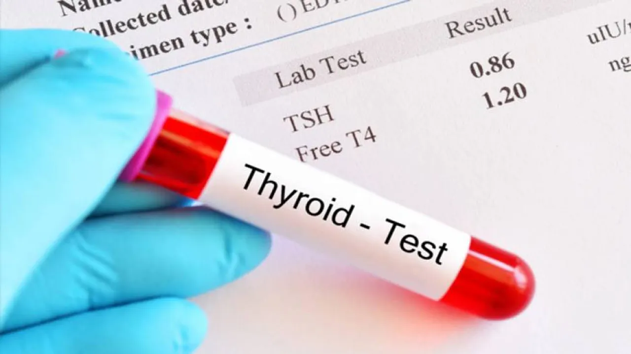Patients With COVID-19 Infection May Develop Thyroid Disease