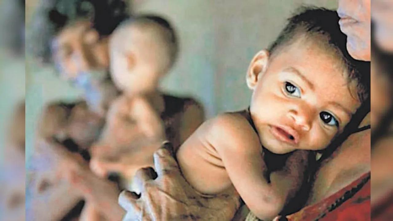 2-Month Lockdown May Surge Number Of Underweight Children By Millions: IIHMR Professor