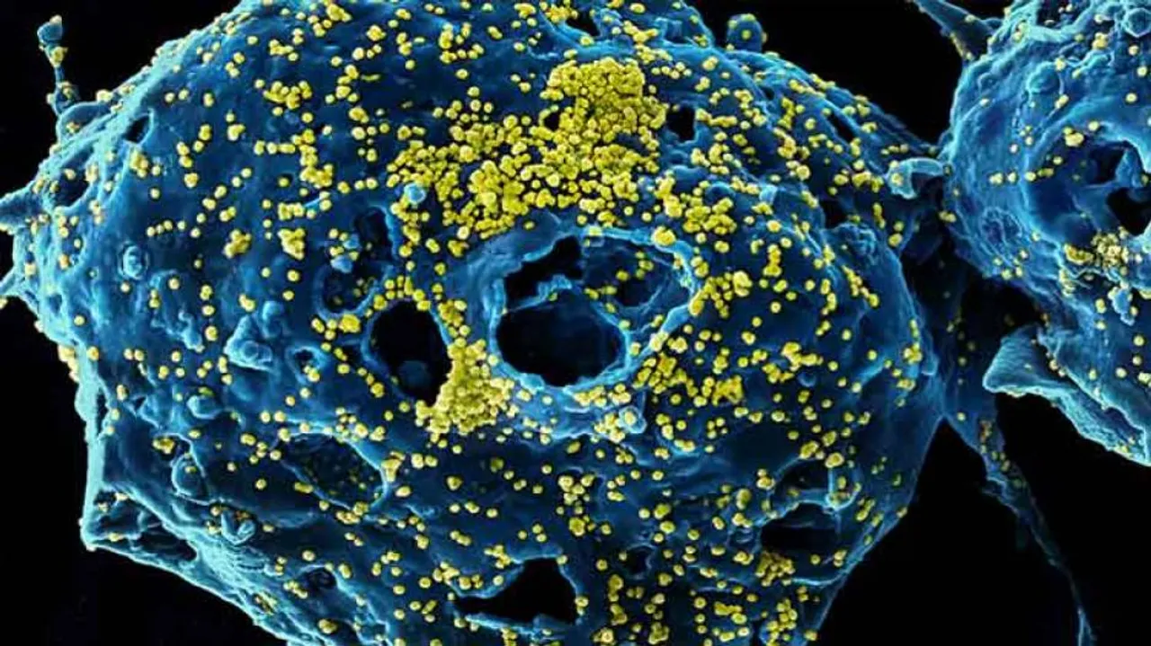 China Warns Of Deadlier Than Corona 'Unknown Pneumonia'