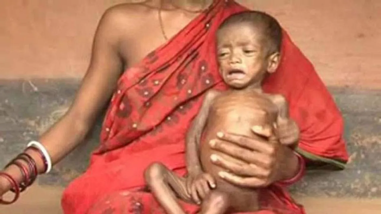 From 1990 - 2017, Malnutrition deaths still haunt Odisha!