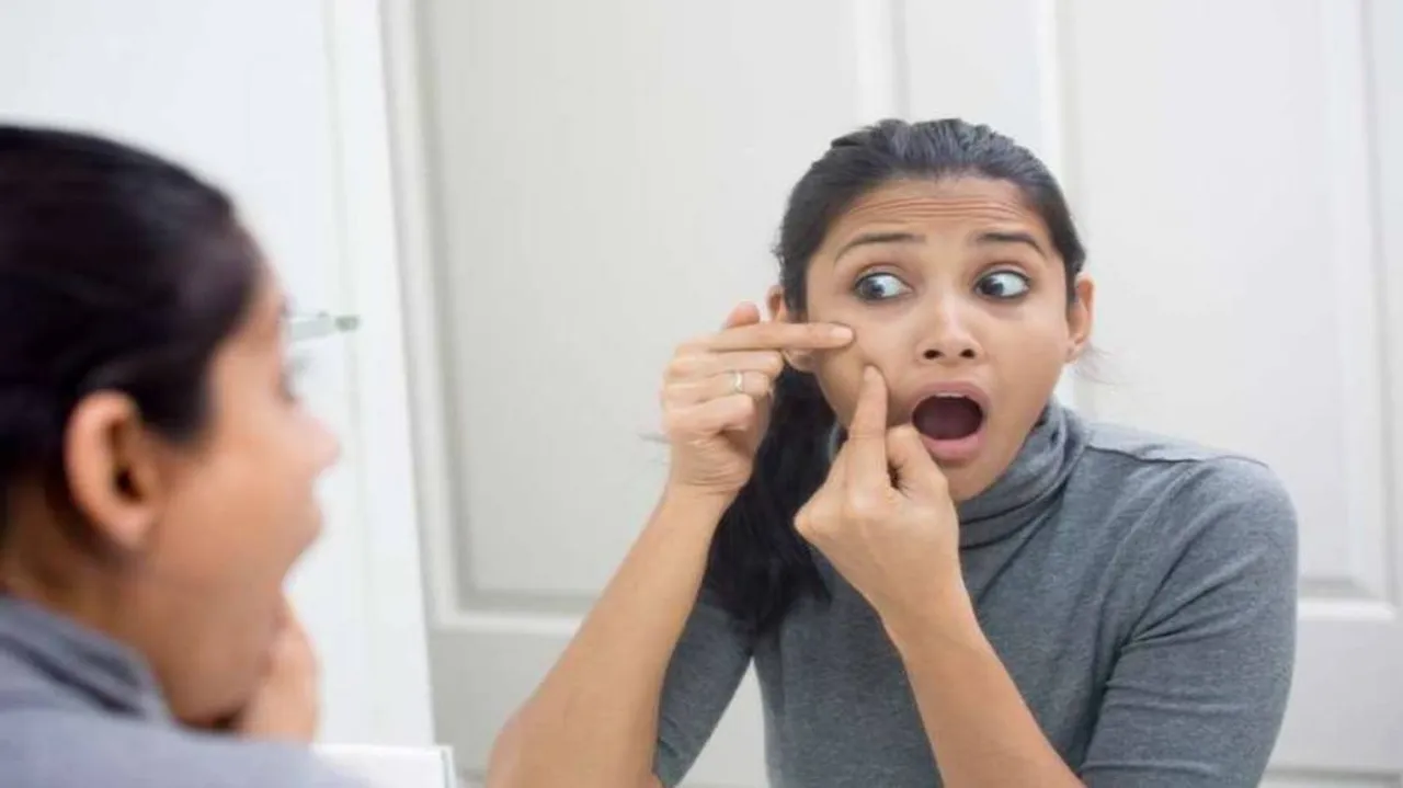 Acne may lead to increased risk of depression