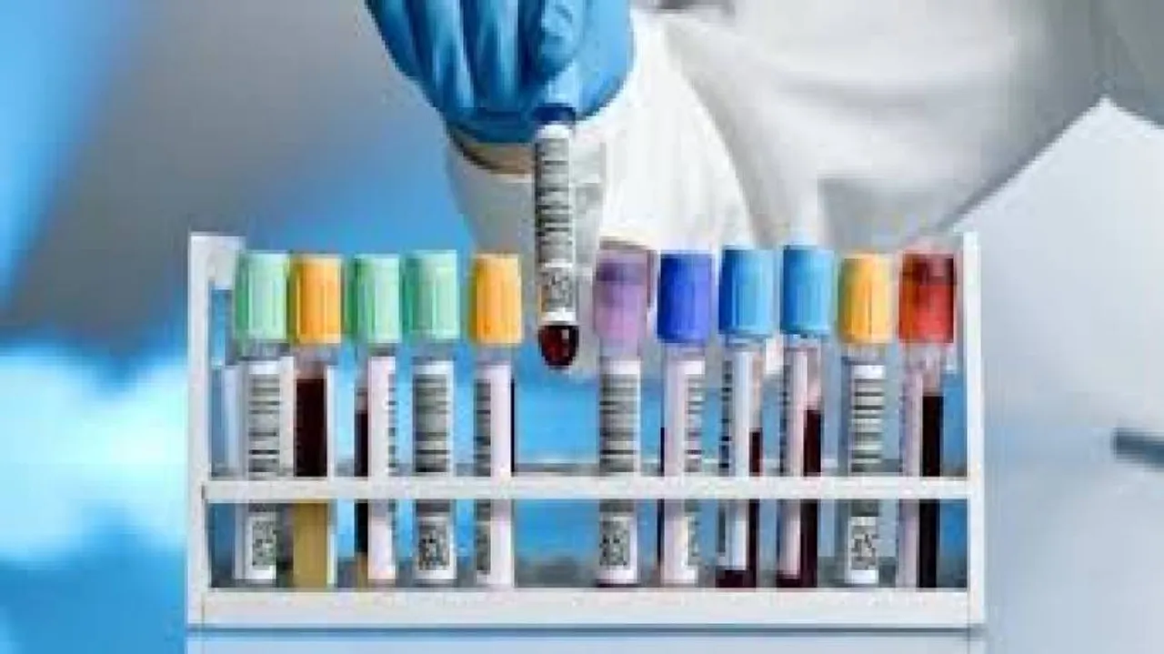 New blood test to predict TB onset two years in advance