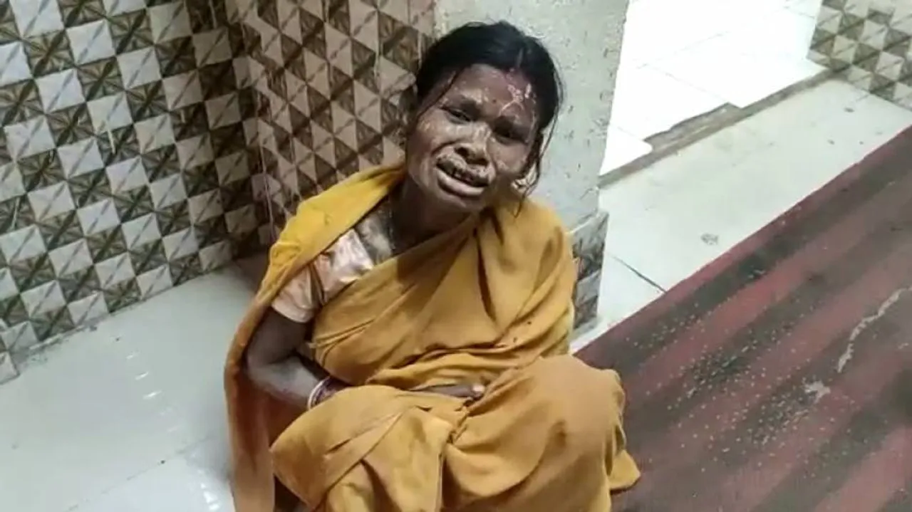 One-Year-Old Girl Dies After Falling In Bore Well Pit In Balasore