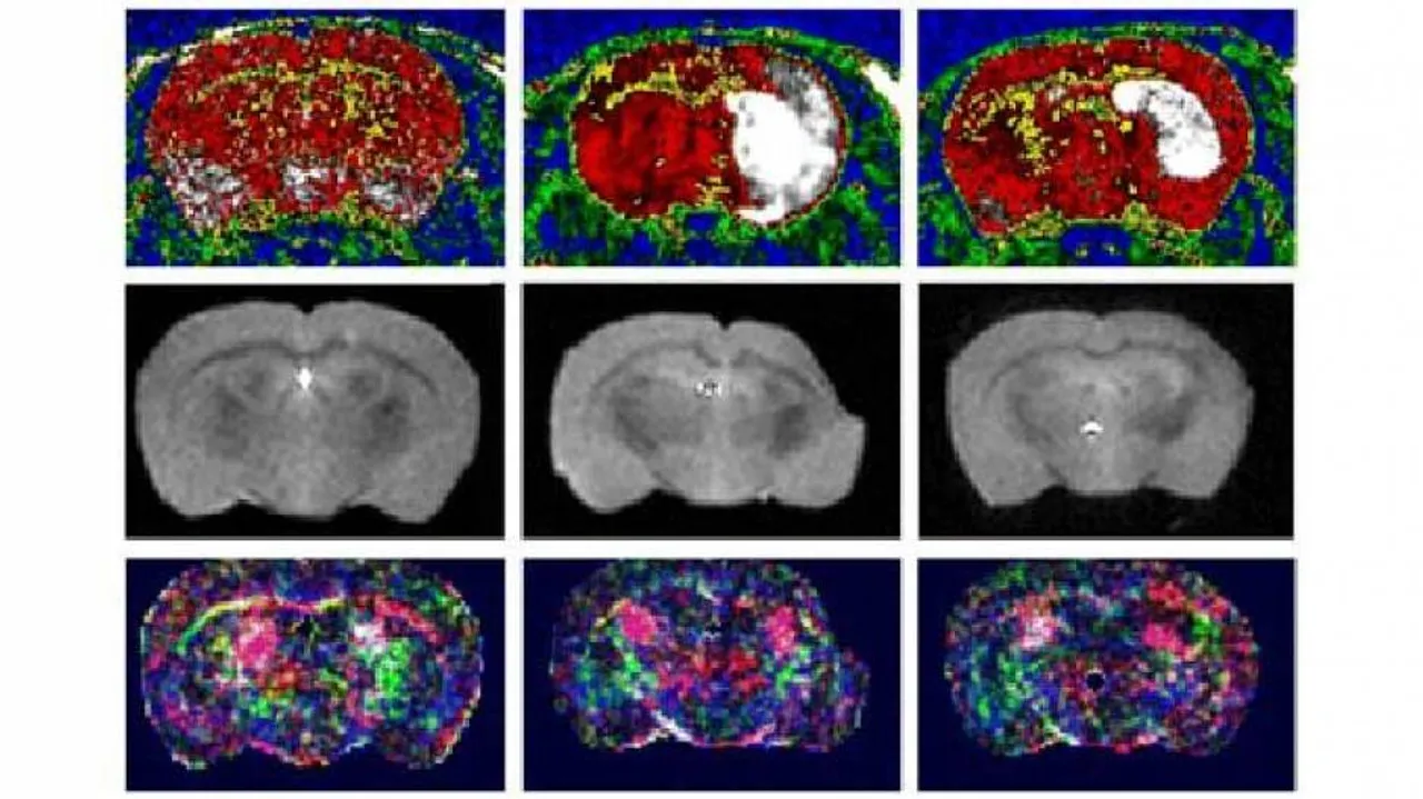 Novel stroke treatment repairs damaged brain tissue
