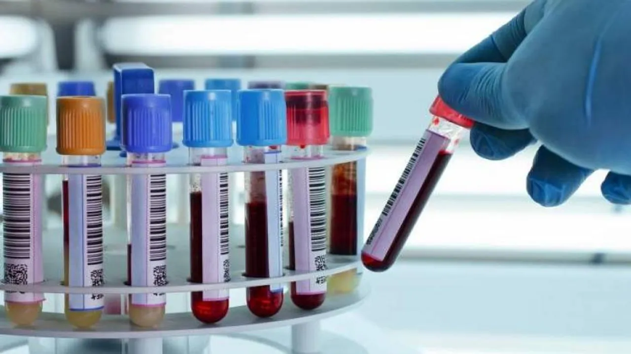 New blood test may help early detection of 8 cancers