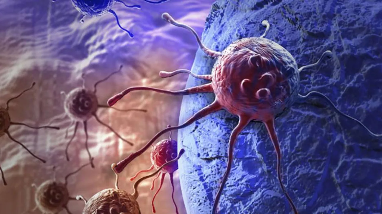 New subtype of prostate cancer identified