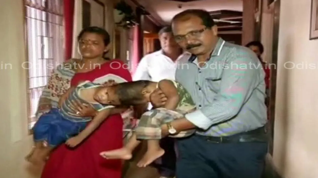 AIIMS renames conjoined twins Jaga, Balia to seek blessings