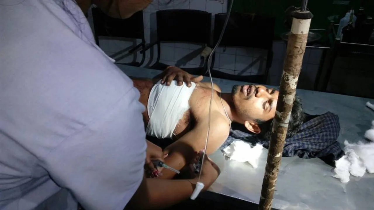 Dacoit injured in accidental firing during loot bid