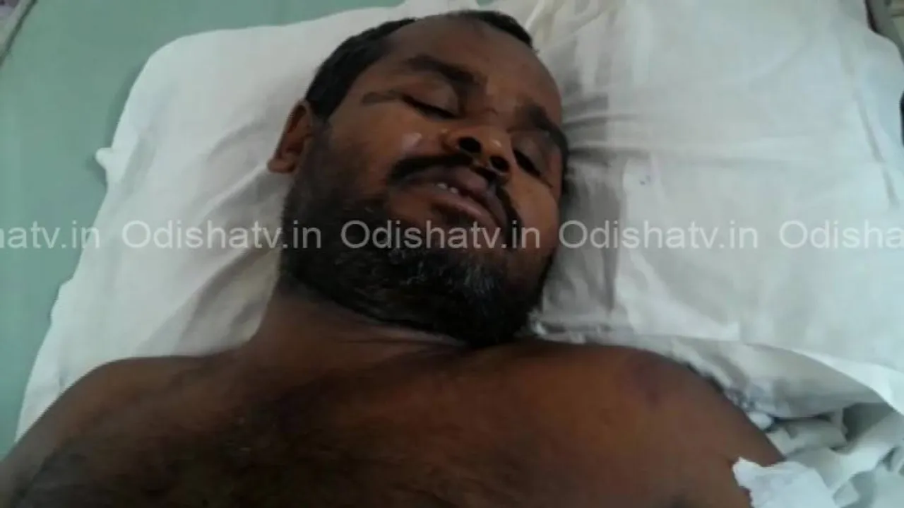 Train mishap turns Divyang singer’s life upside down