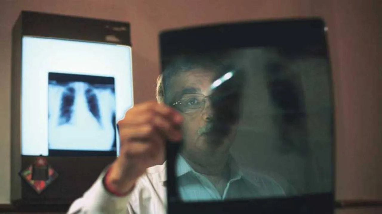 Spike in respiratory patients due to air pollution in Delhi