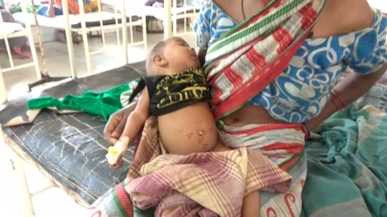 Parents brand baby with hot iron to cure stomach ailment
