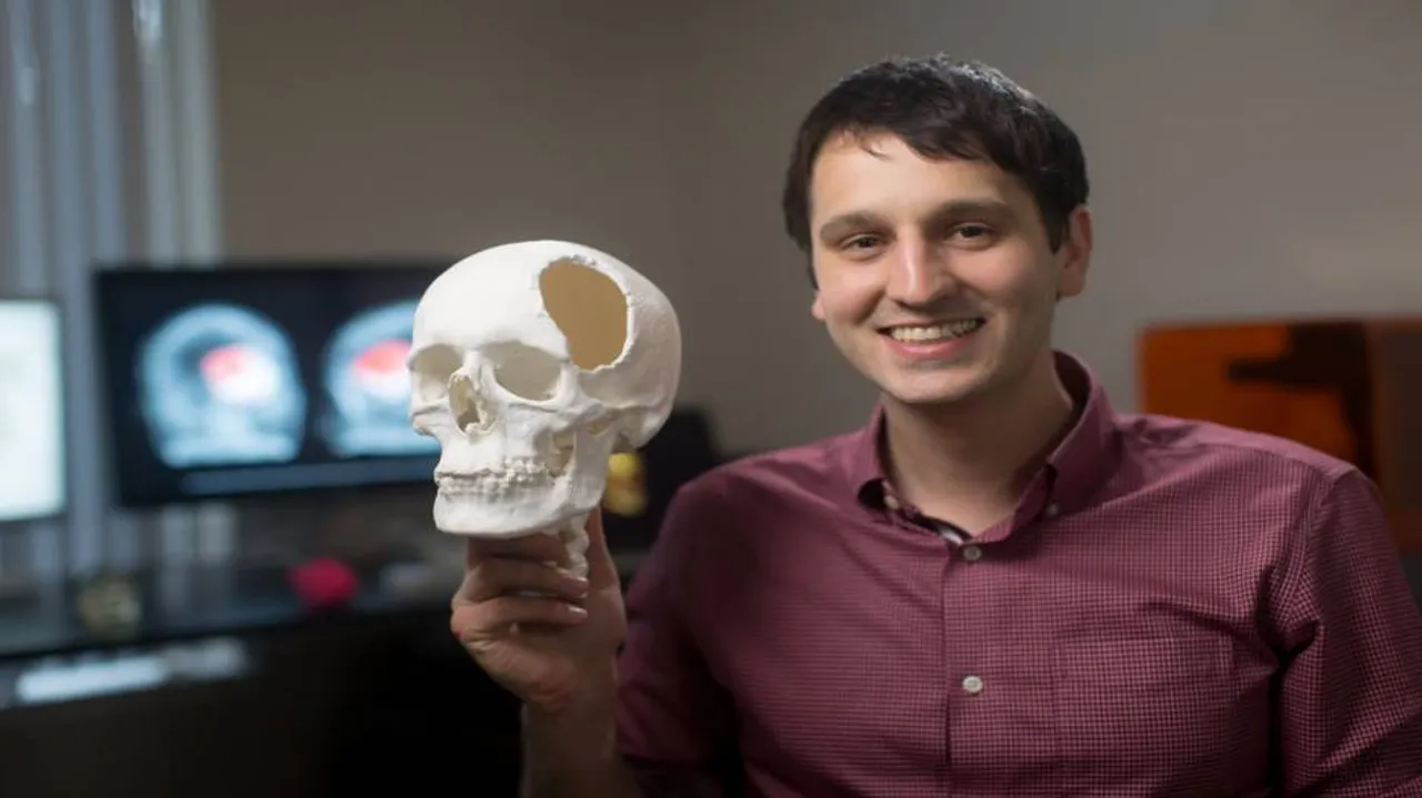 Apple hires man who 3D printed his brain tumour