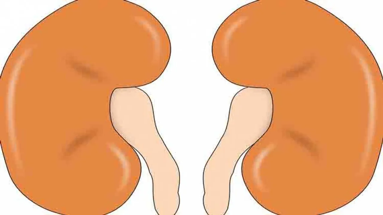 Kidney swap unites Hindu, Muslim families