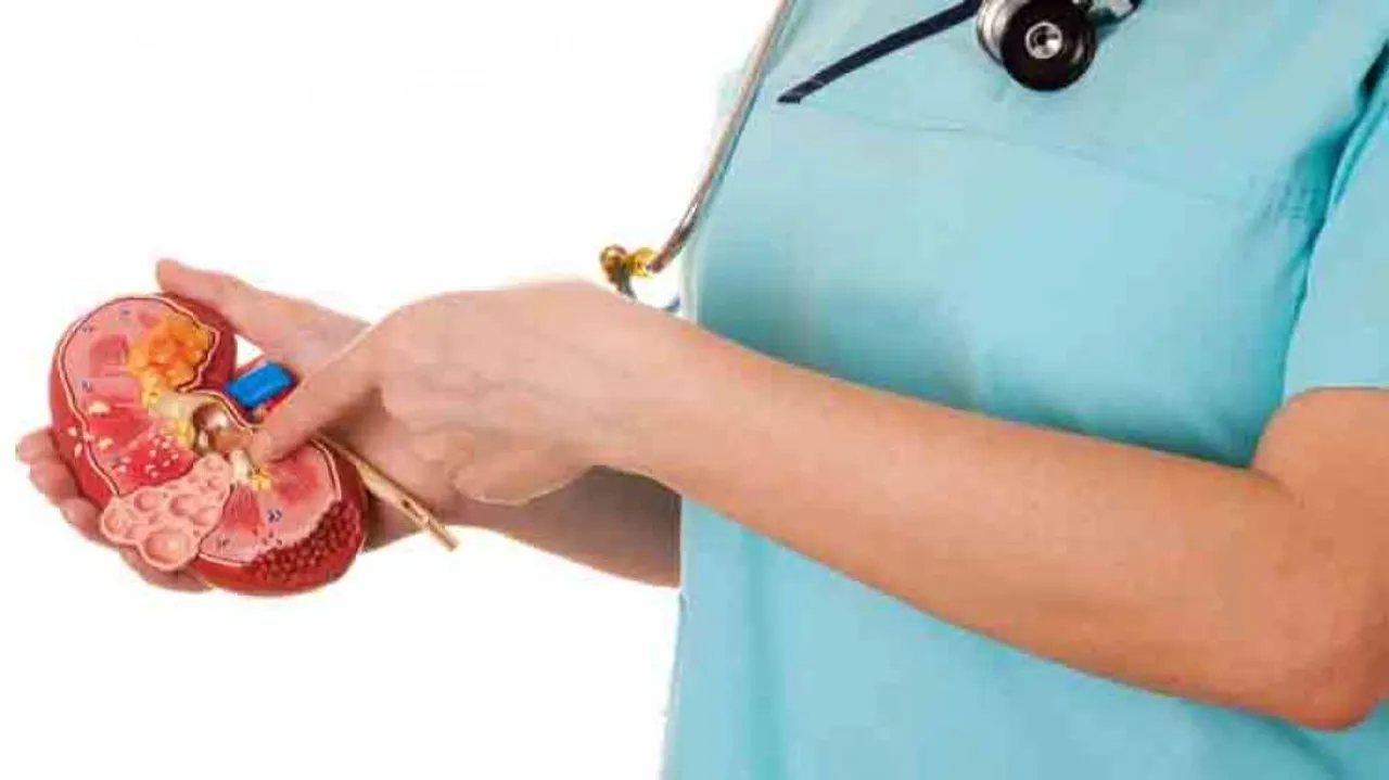 Kidney stones partially dissolve naturally: Study