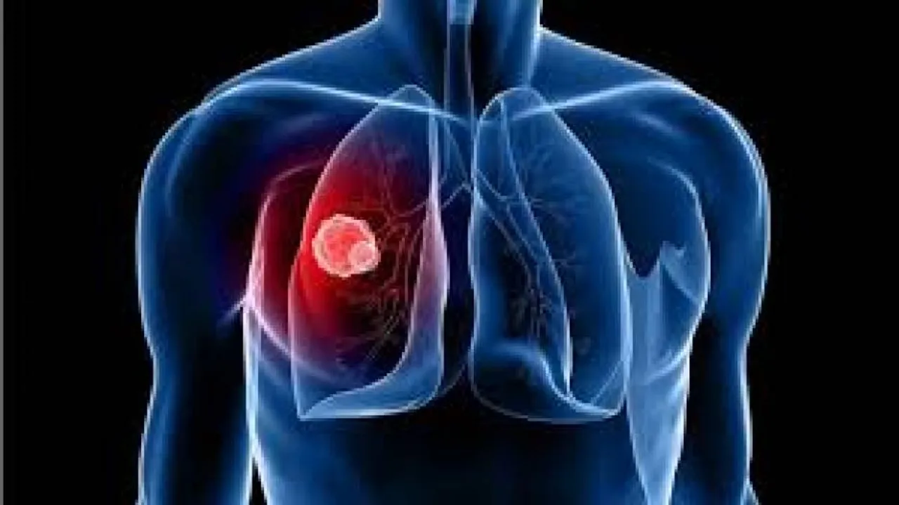 Chilli compound slows lung cancer progression, claims study