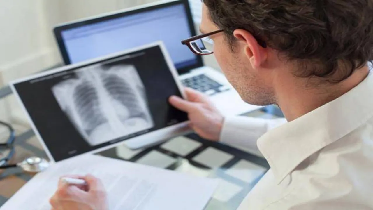 Hormone therapy may combat lung function decline in women