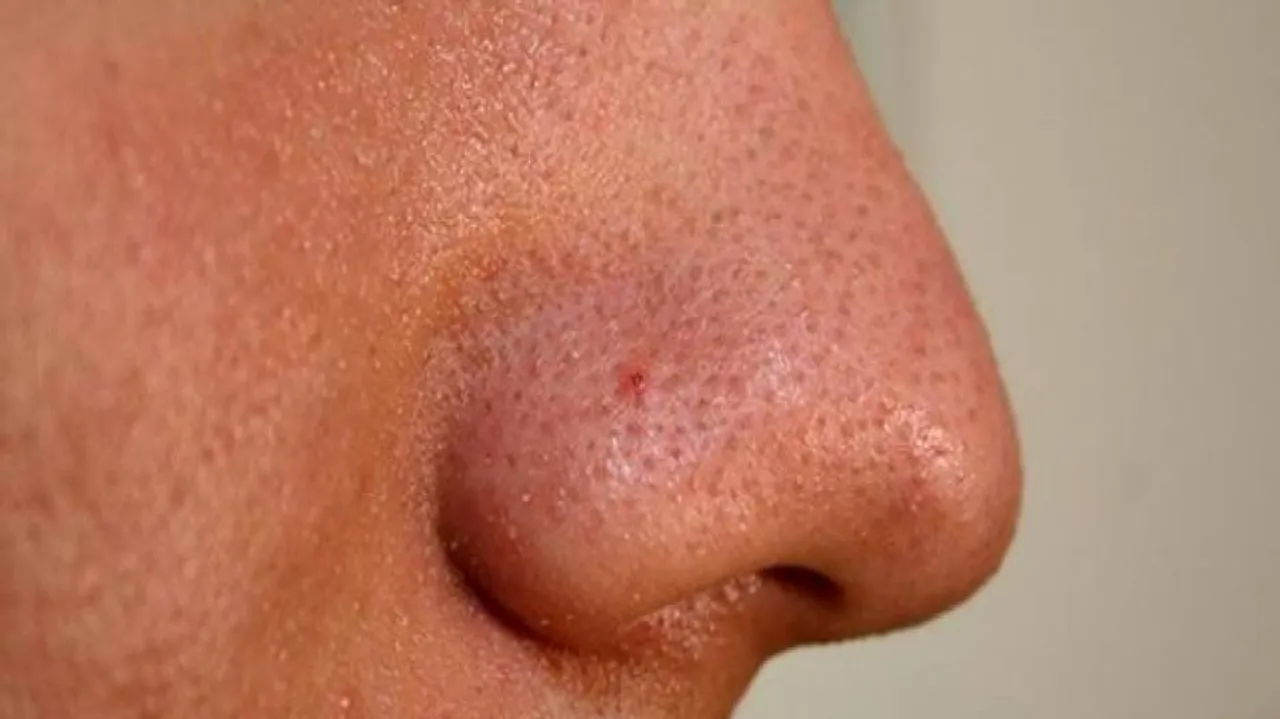 Human-like nose to sniff out bacteria in drinking water