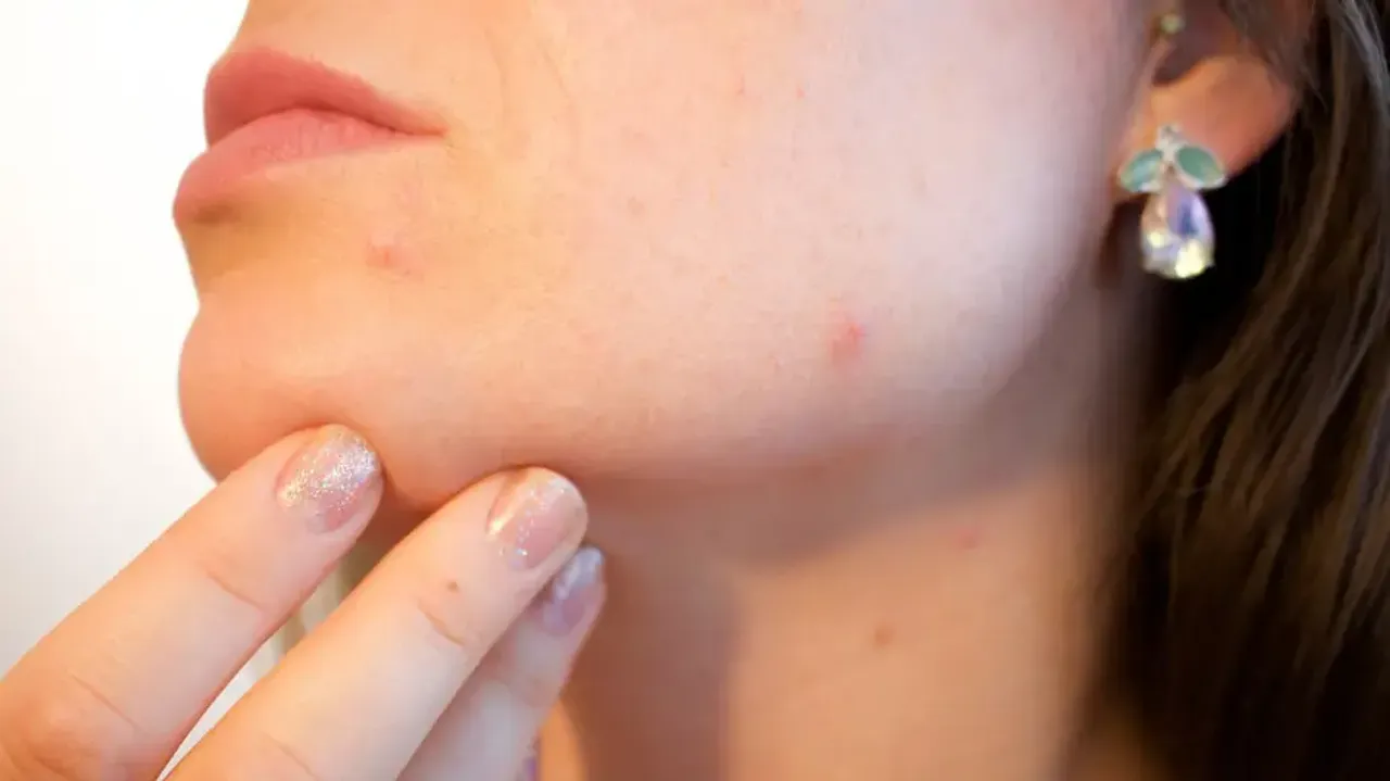 summer skin problems