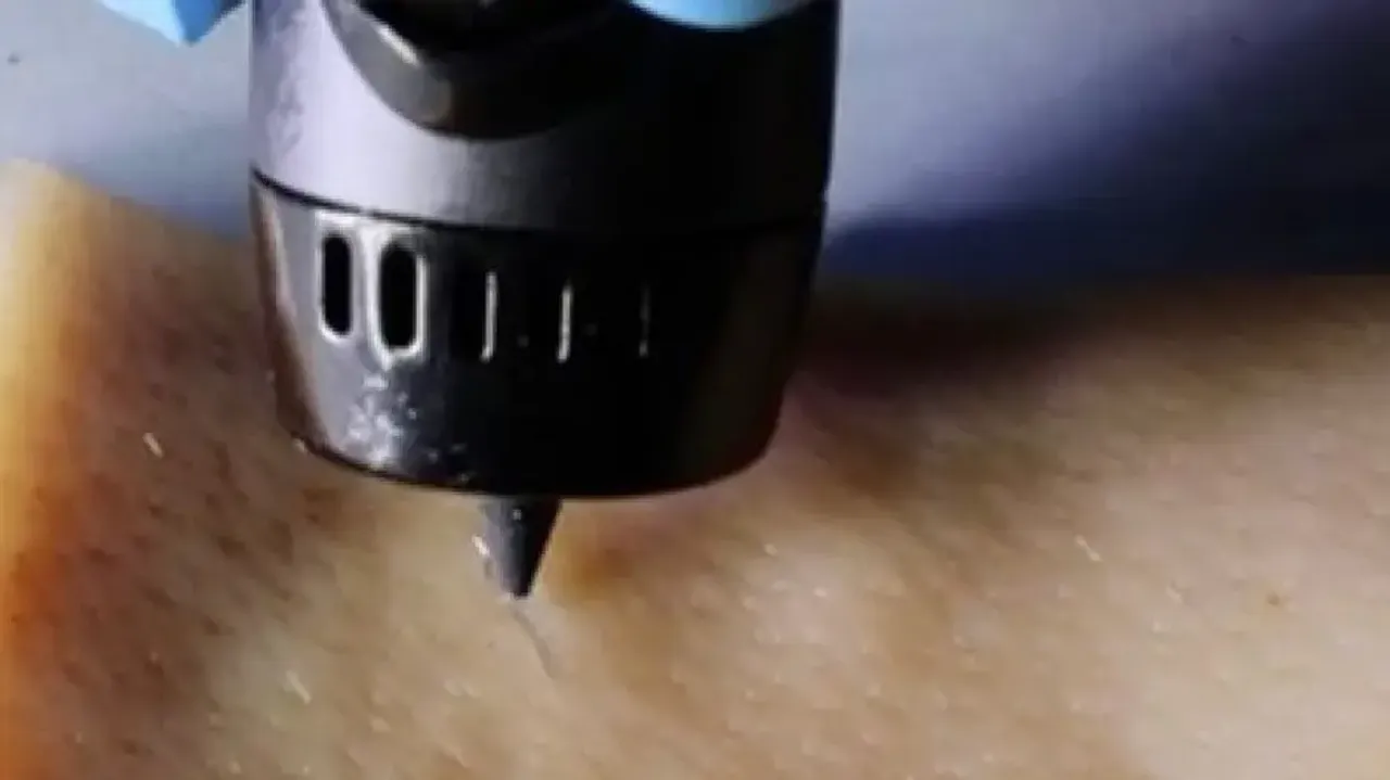 New wound-healing ink repairs cuts with a 3D-printing pen