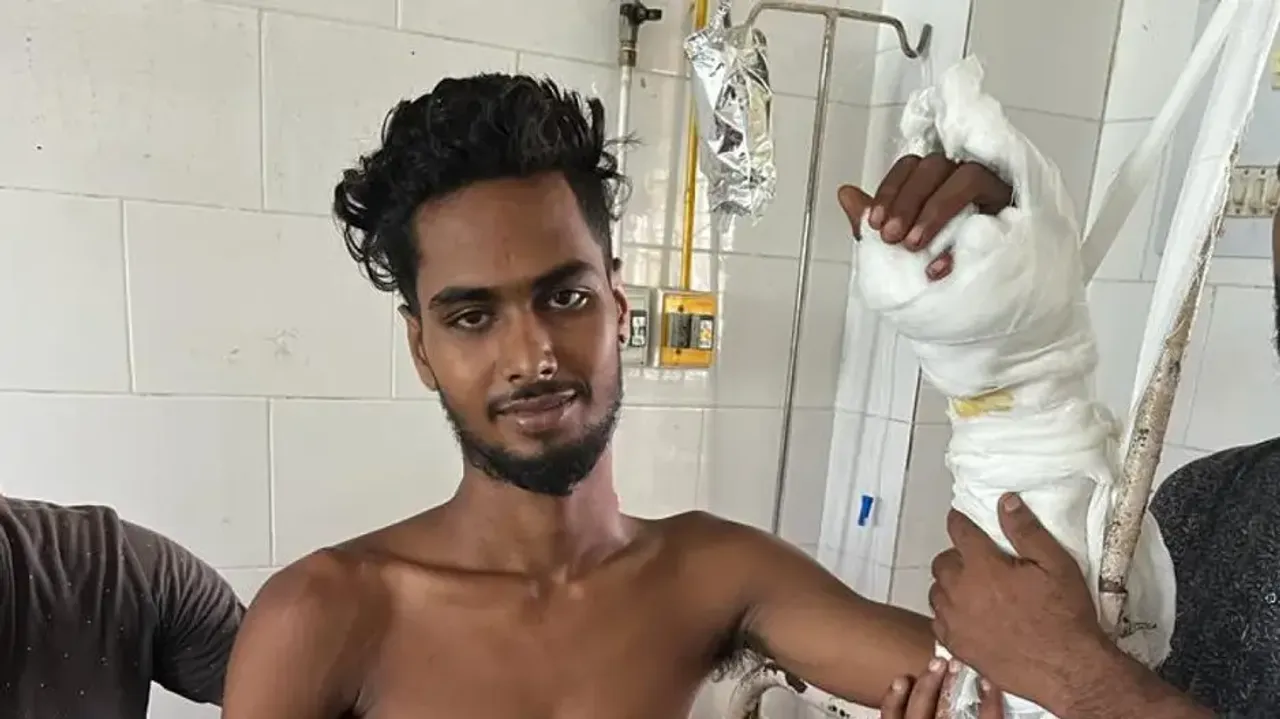 Chopped hand replanted