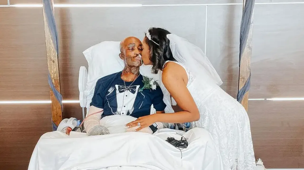 Couple gets married in hospital after groom sustained 32% burn injuries 