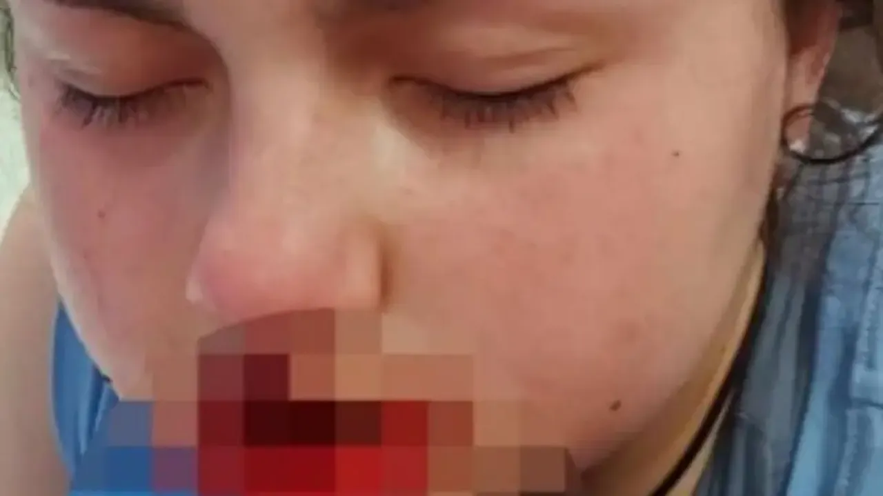 12-year-old girl horrifically mauled by pet dog in Australia