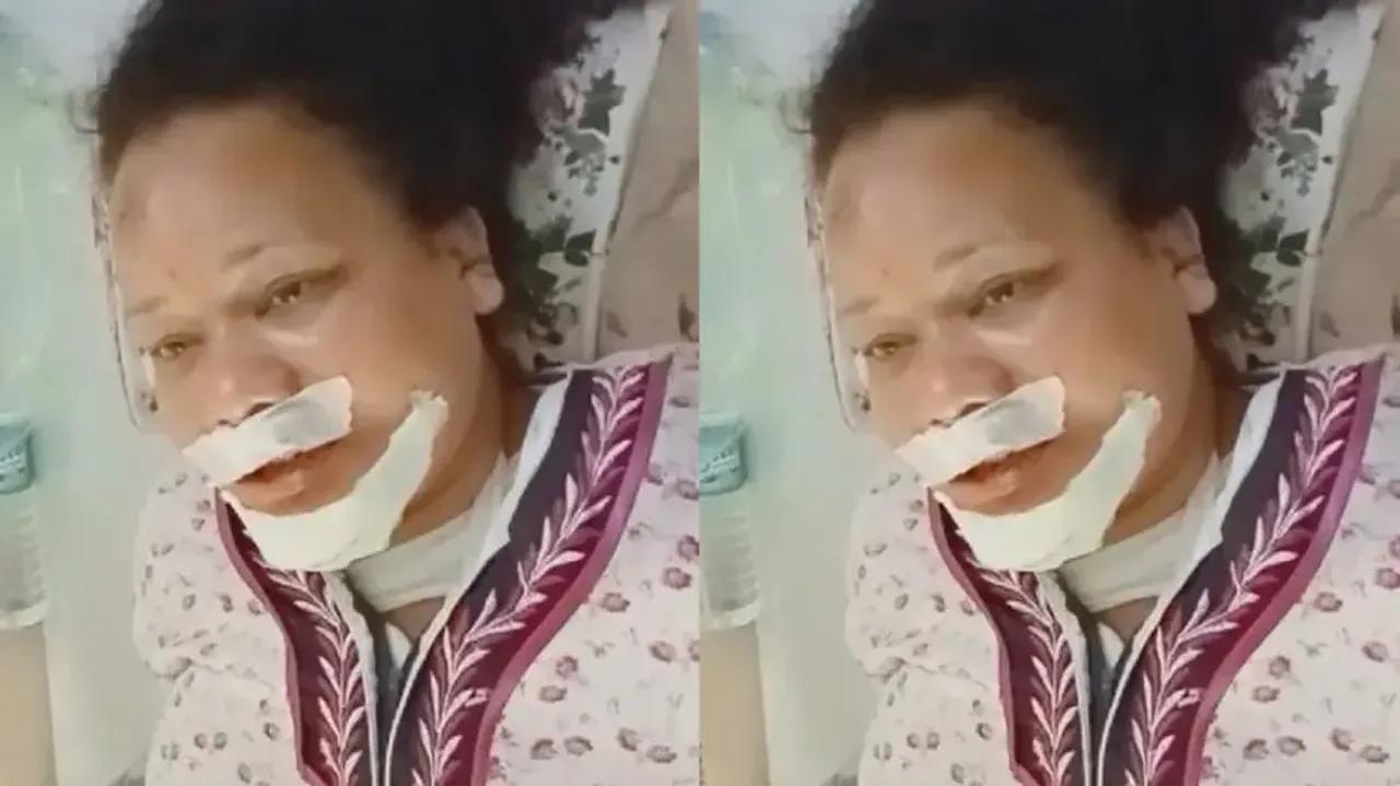 Woman critical after man who offered lift throws her off speeding bike as she resists molestation bi