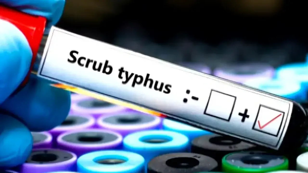 Scrub Typhus