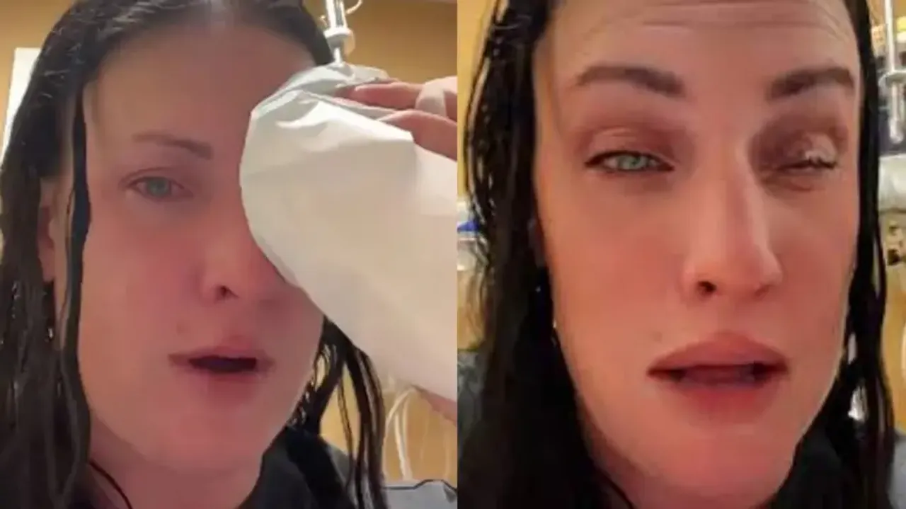 California woman uses superglue as eye drops 