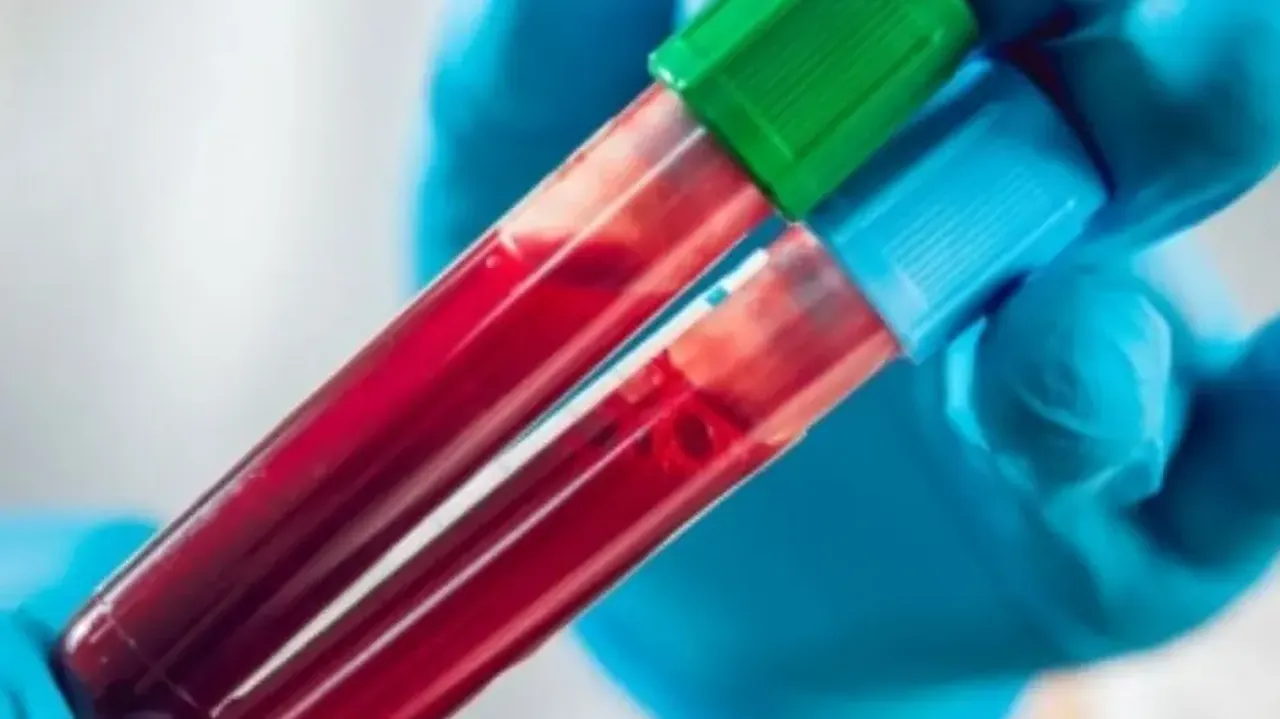 New blood test may detect ovarian cancer early with 91% accuracy