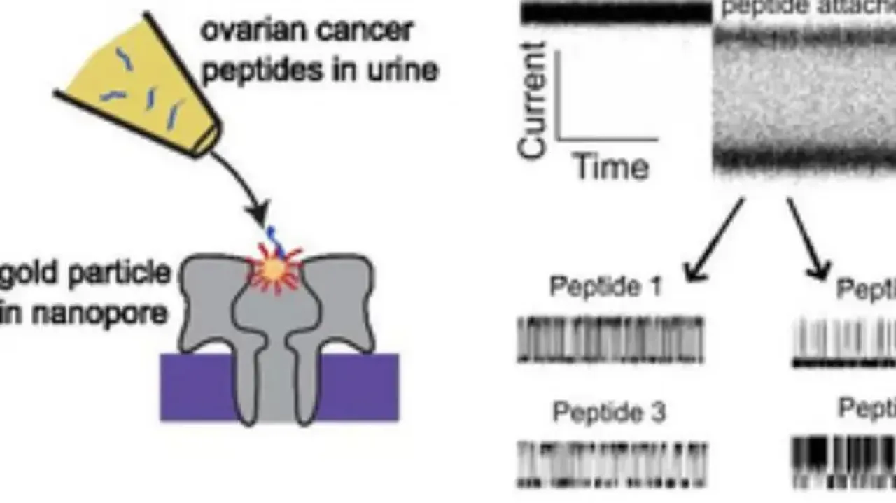 Urine Test to detect Cancer 