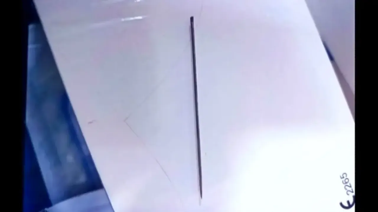 Needle Removed From Patient's Heart